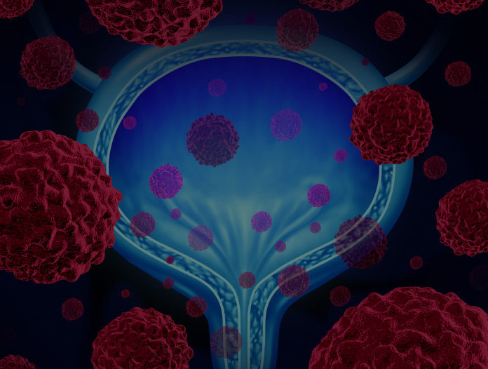 GU Oncology: Prostate/Testis/Urethra/Penis