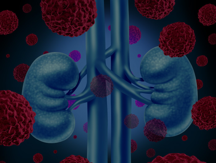 GU Oncology: Kidney