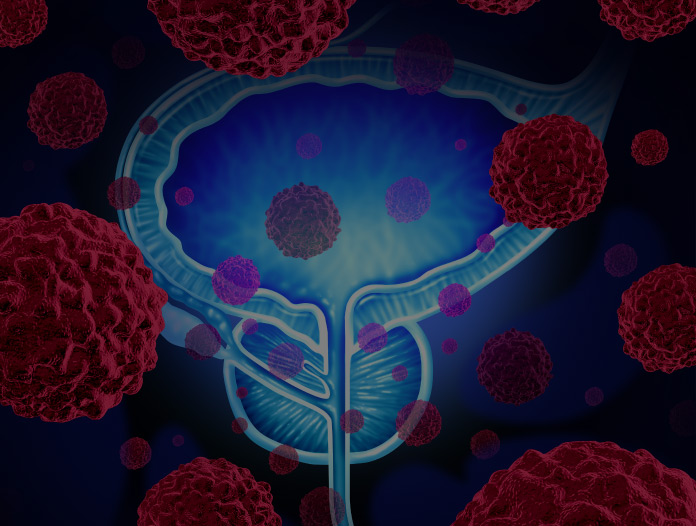 GU Oncology: Renal Pelvis, Ureter, and Bladder