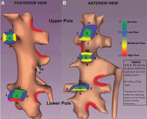 Kidney-Map