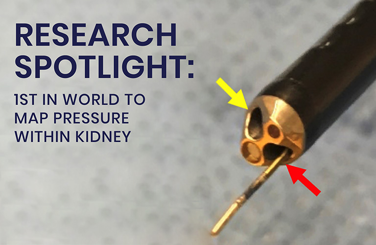 UCI-Urology-Newsletter-XV-Research-Spotlight