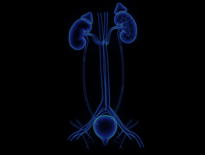 Urinary Tract Obstruction