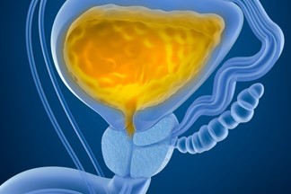 Does removing the bladder cure bladder cancer?