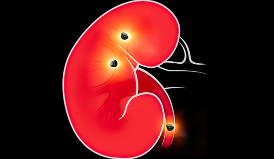 Kidney-Diagram