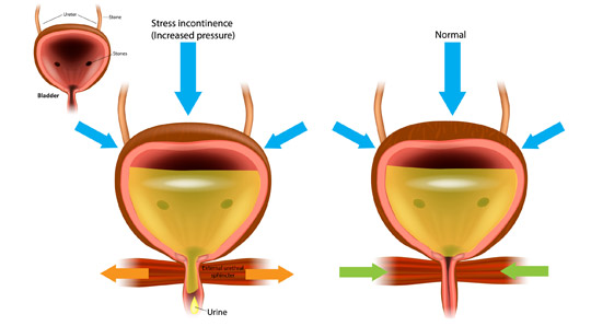 Urinary-Bladder-Diagram