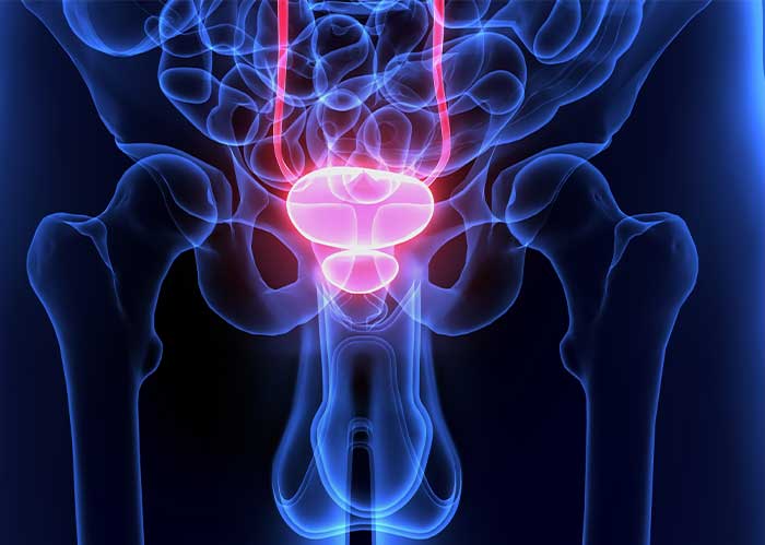 prostate-isolated-Artemis-biopsy-UCI-Urology